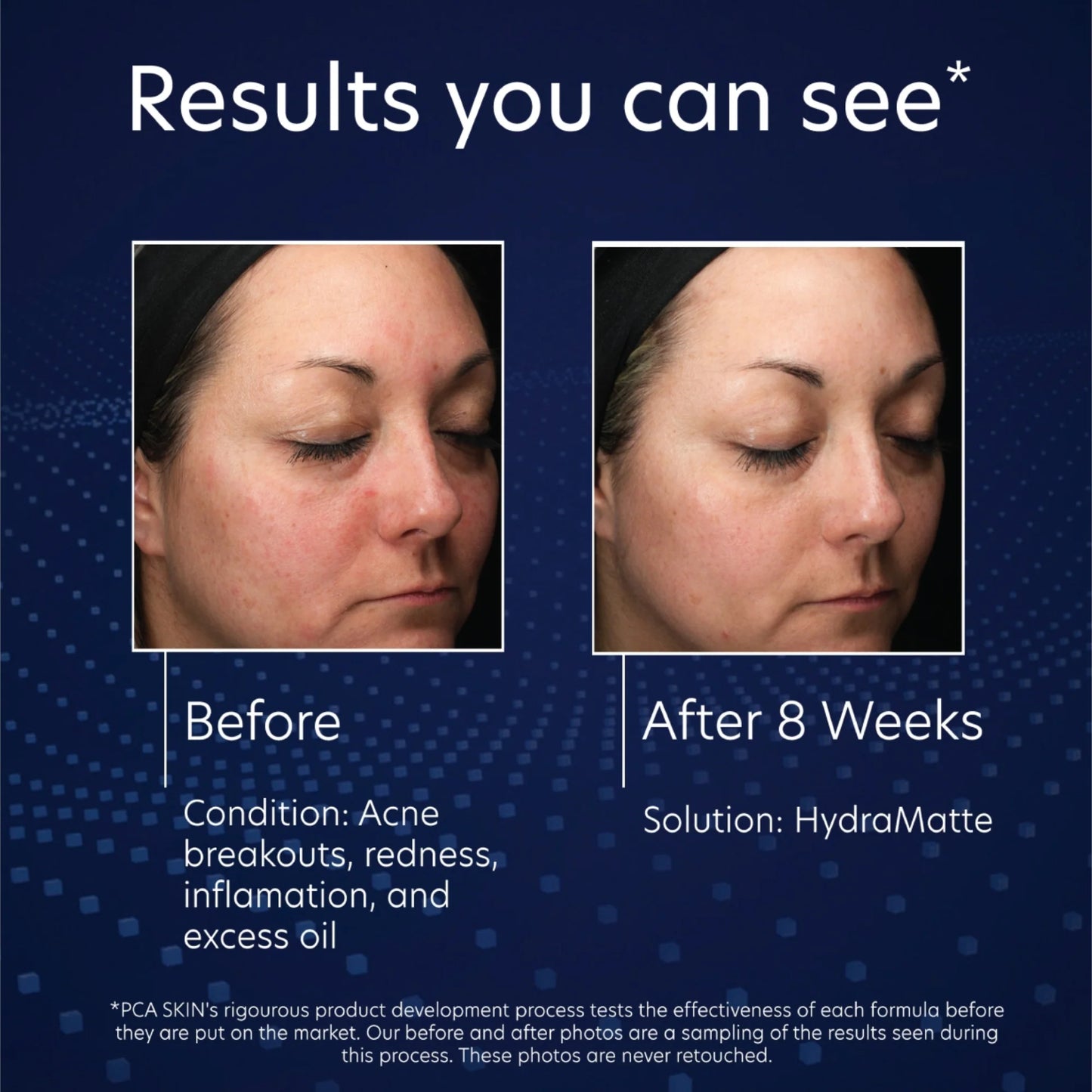 HYDRAMATTE 51G $99