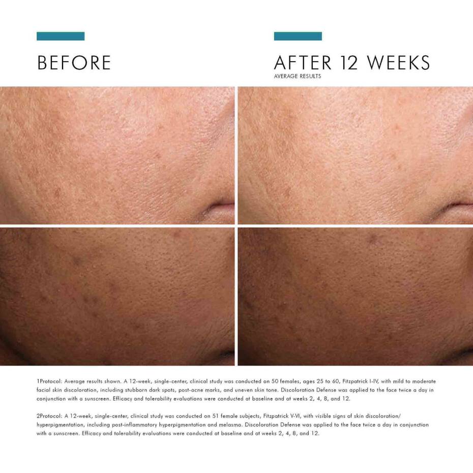 DISCOLORATION DEFENSE 30ML $149