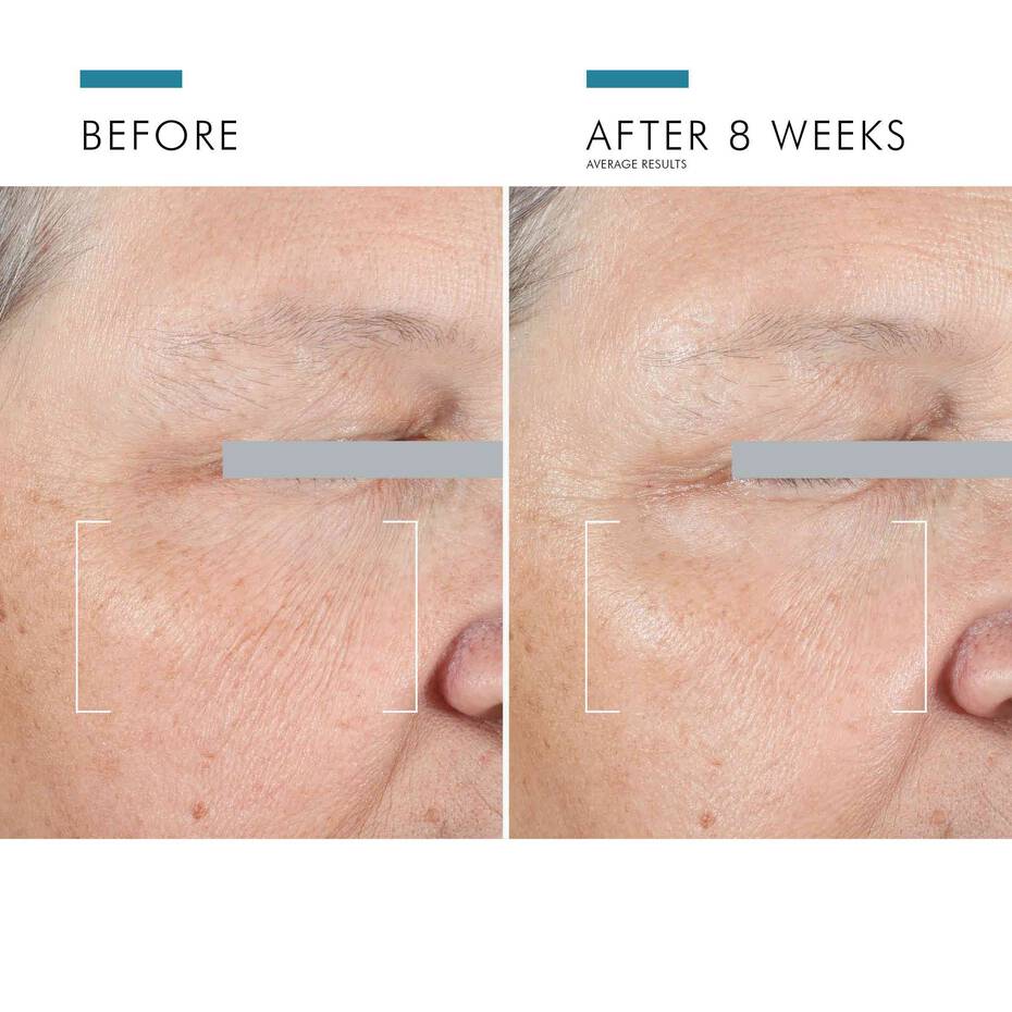 A.G.E ADVANCED EYE 15ML $139