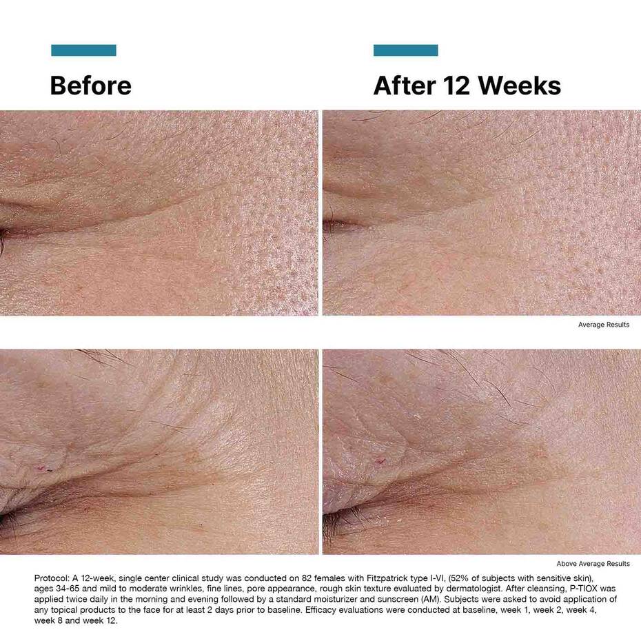 P-TIOX PEPTIDE SERUM 30ML $169