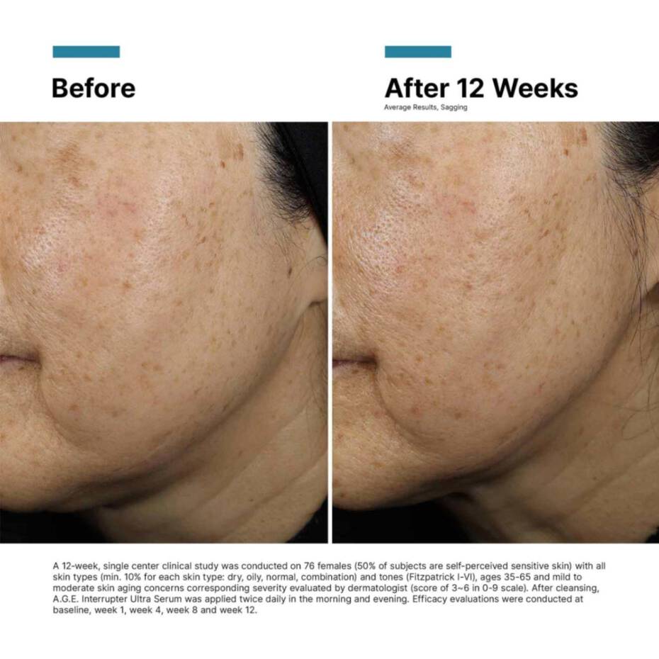 A.G.E INTERRUPTER ULTRA SERUM 30ML $209
