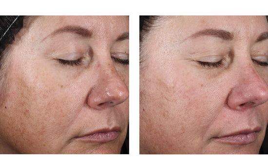 ALTO ADVANCED DEFENSE AND REPAIR SERUM 30ML $245