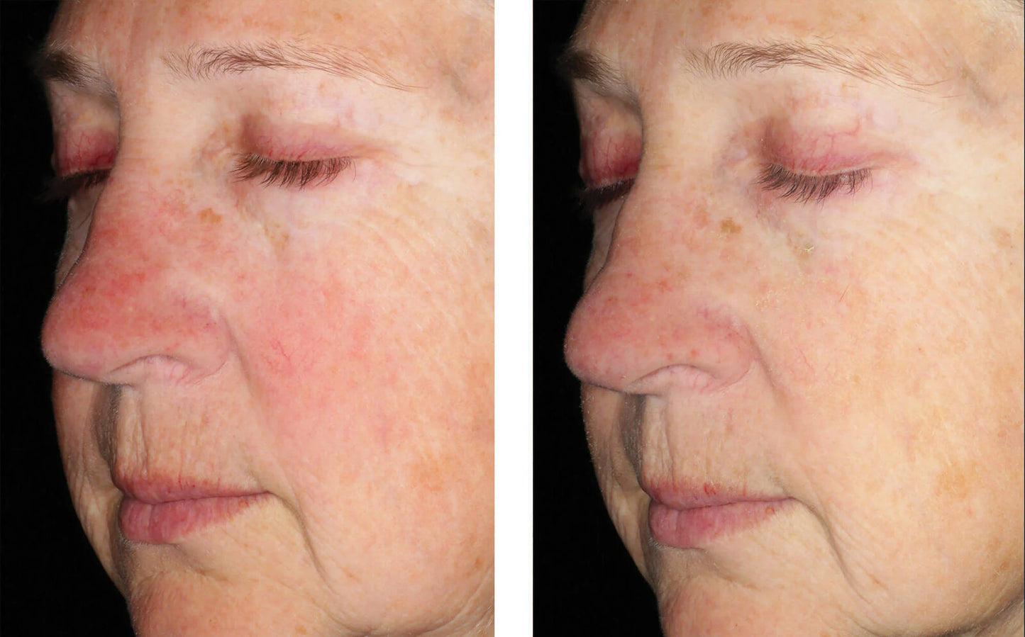 ALTO DEFENSE SERUM 30ML $205