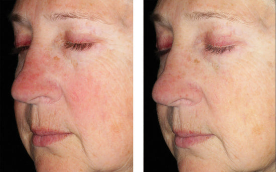 ALTO DEFENSE SERUM 30ML $205