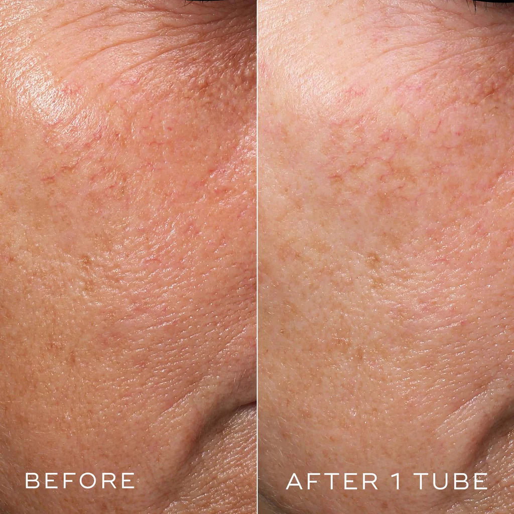 CRYSTAL RETINAL 1 $69