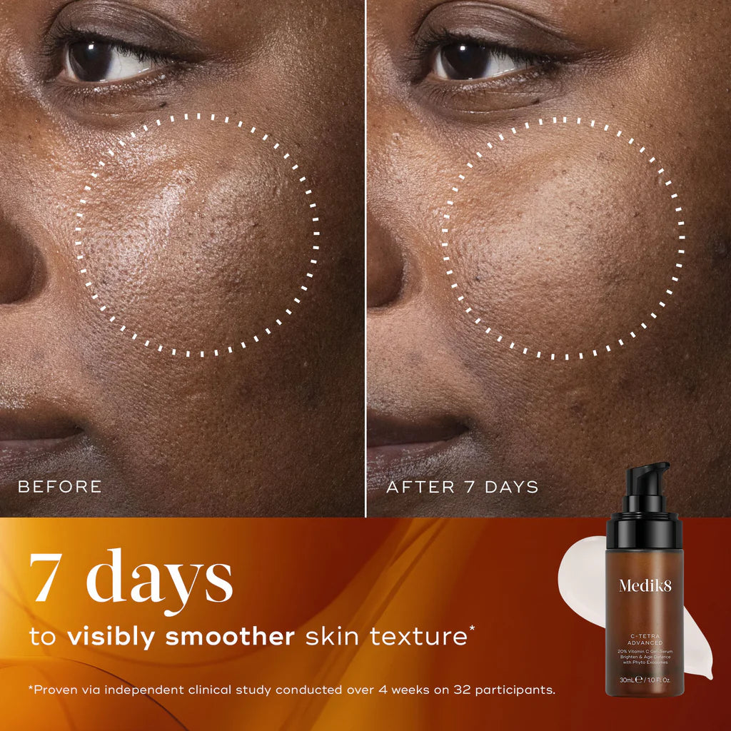 C-TETRA ADVANCED 30ML $109