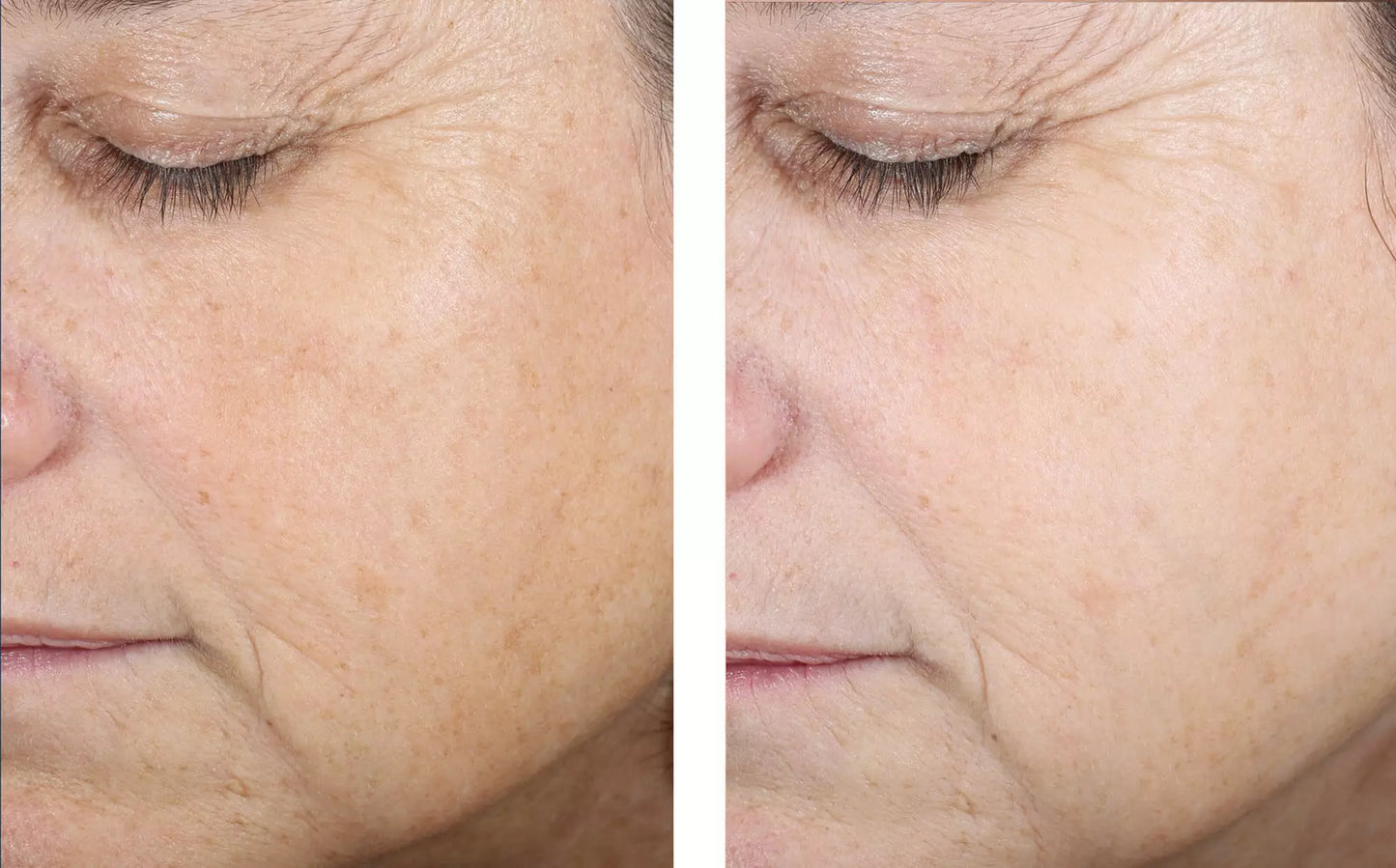 EVEN SKIN TONE CORRECTING SERUM 50ML $219