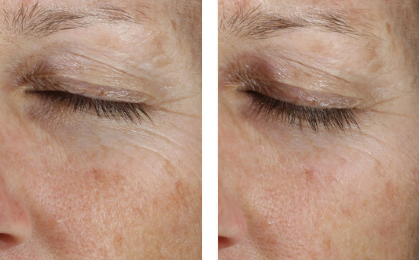 INSTANT EFFECT GEL EYE 15ML $135