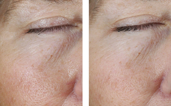 INSTANT EFFECT GEL EYE 15ML $135