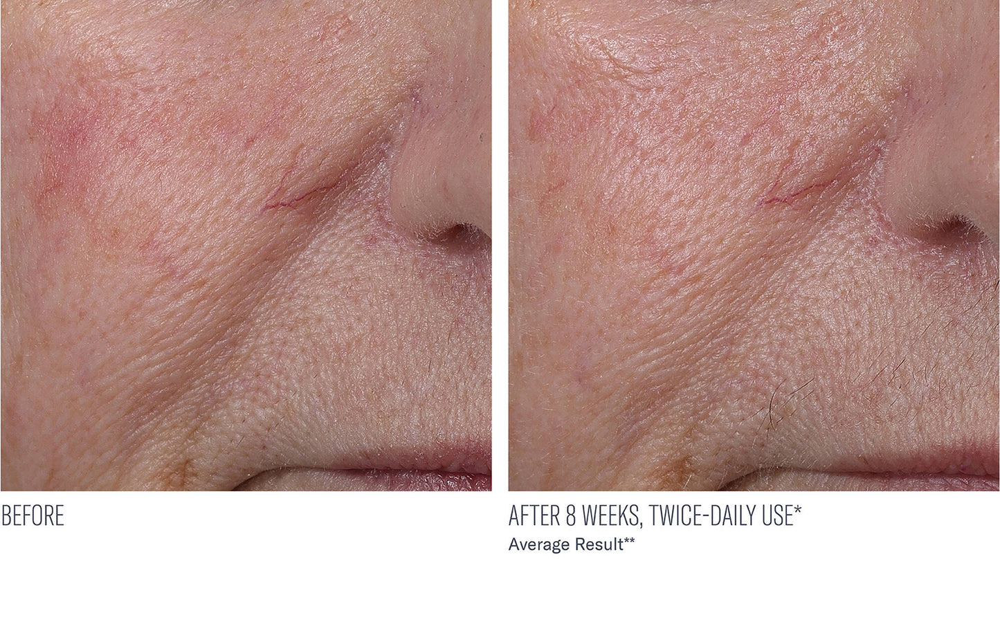 INTERFUSE TREATMENT CREAM FACE AND NECK 30ML $165