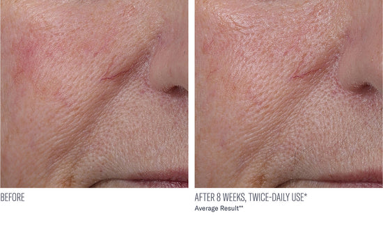 INTERFUSE TREATMENT CREAM FACE AND NECK 30ML $165