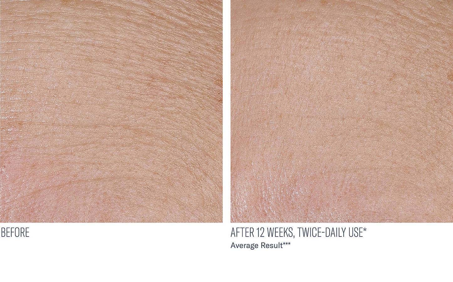 INTERFUSE TREATMENT CREAM FACE AND NECK 30ML $165