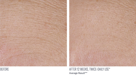 INTERFUSE TREATMENT CREAM FACE AND NECK 30ML $165