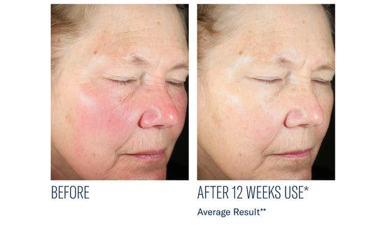 EVEN INTENSIVE SKIN TONE CORRECTING SERUM 50ML $245