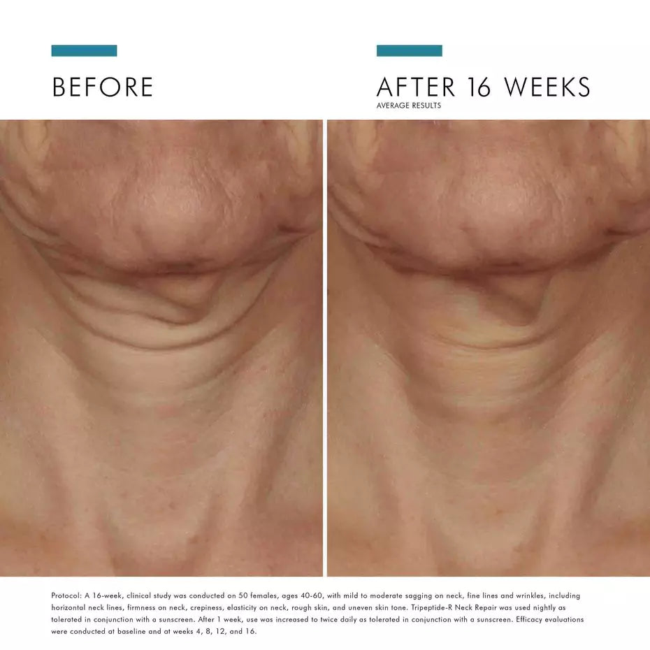 TRIPEPTIDE-R NECK REPAIR 50ML $189