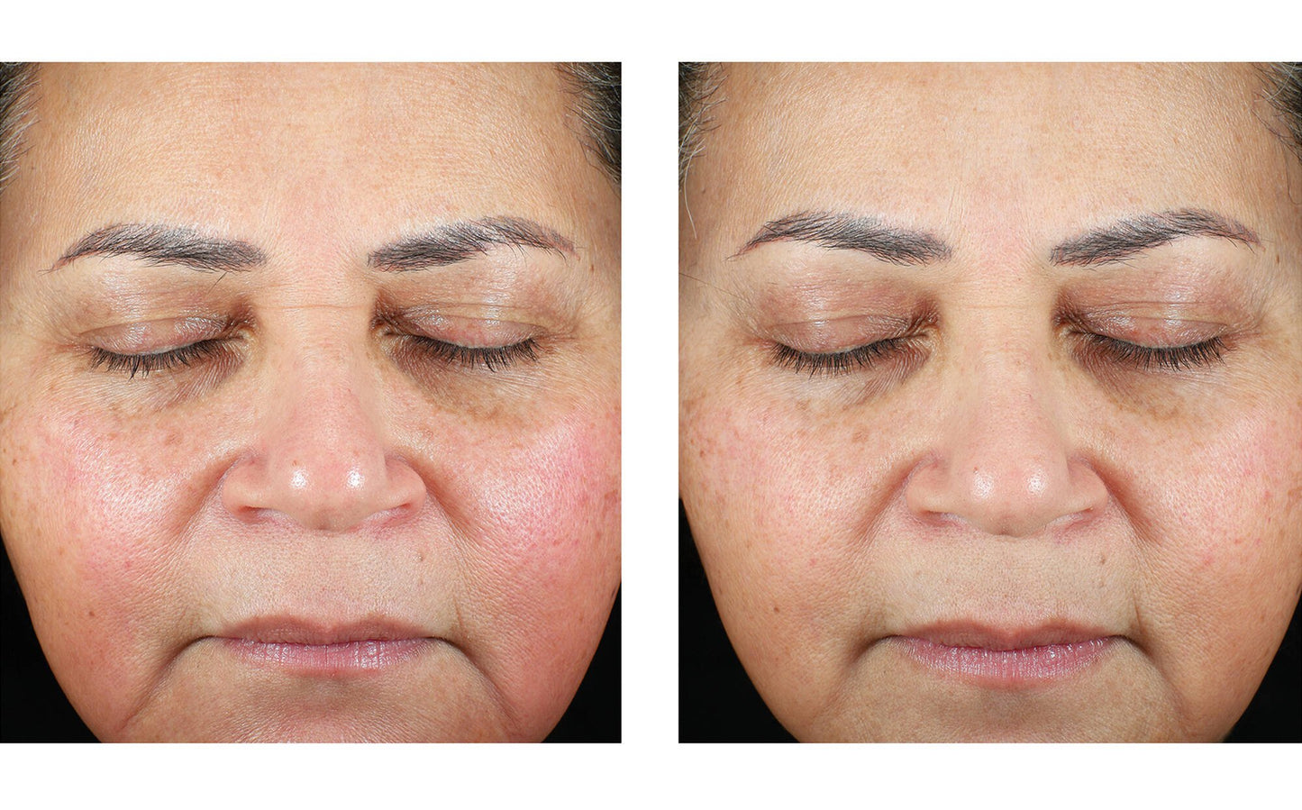 TRIO LUXE MOISTURE TREATMENT 50ML $275