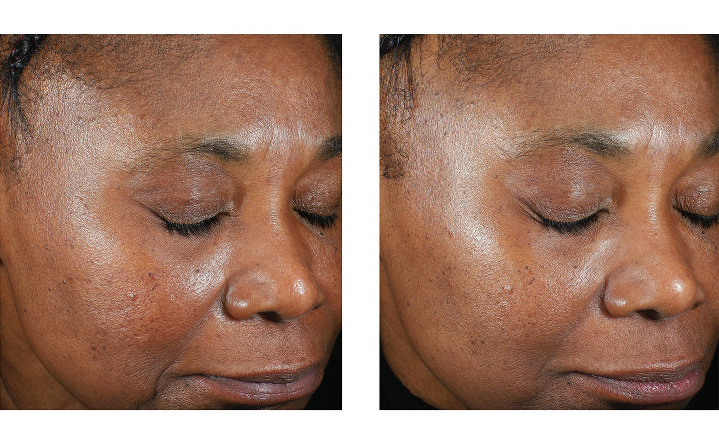 TRIO LUXE MOISTURE TREATMENT 50ML $275