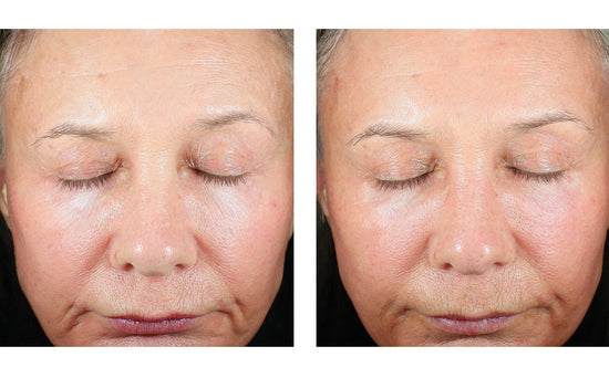 TRIO LUXE MOISTURE TREATMENT 50ML $275