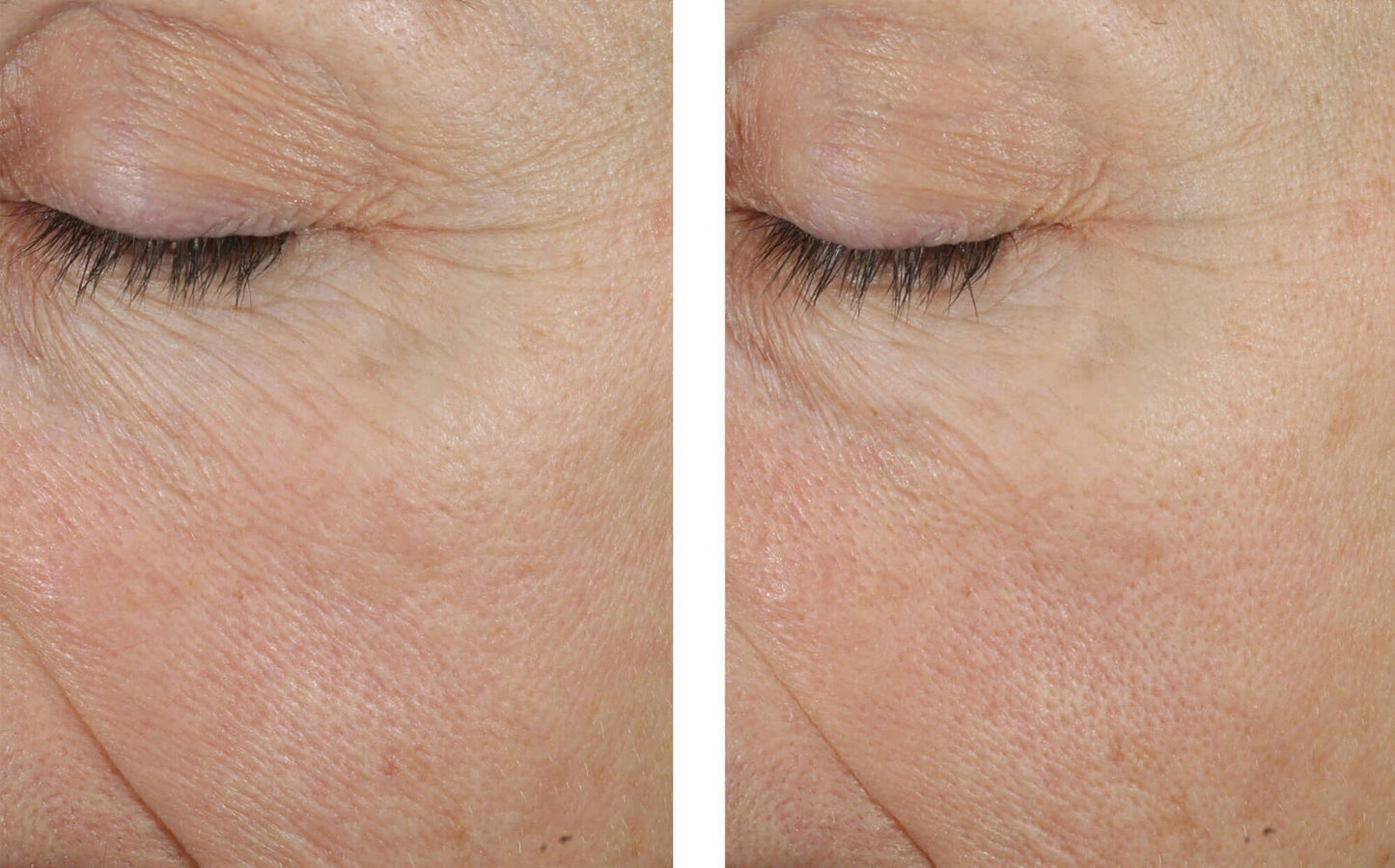 TRIO REBALANCING MOISTURE TREATMENT 50ML $215