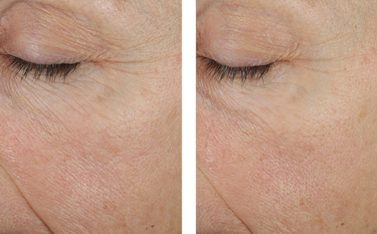 TRIO REBALANCING MOISTURE TREATMENT 50ML $215