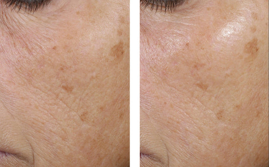 TRIO REBALANCING MOISTURE TREATMENT 50ML $215