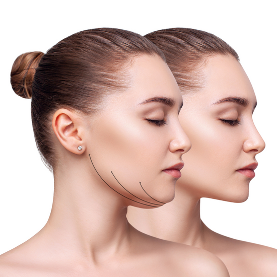 best cosmetic injectables in tamworth